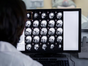 Вештачка интелигенција нуди револуцију у дијагностици канцера