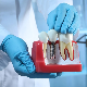 Истине и заблуде о зубним имплантима