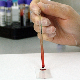 Научници развили тест из крви за мерење степена анксиозности