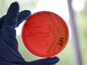 Пронађен нови начин лечења инфекција бактеријoм отпорном на антибиотике
