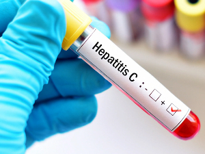 Хепатитис Ц – подмукао вирус, али и те како излечив