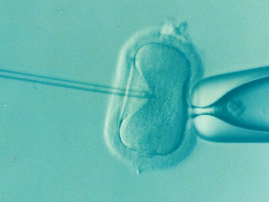 Четири чињенице о замрзавању јајних ћелија
