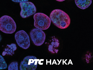 Светски: лекција 2,	Шишарица