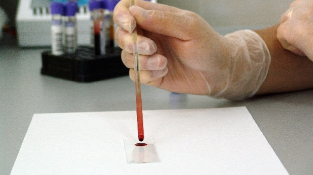 Кап крви за откривање ризика од многих болести  