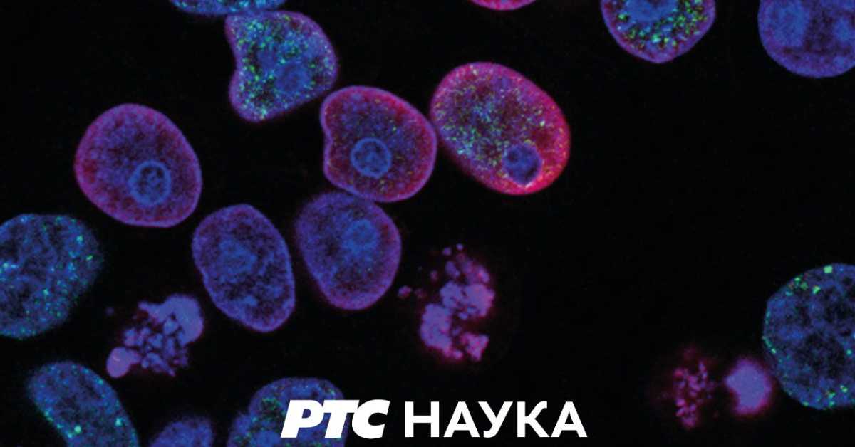 Приђи ближе: Цео свет је позорница, 14. еп.