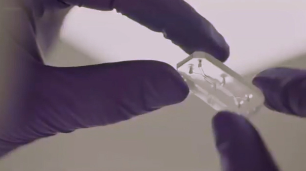 Како сићушни чип даје информације о стању наших црева