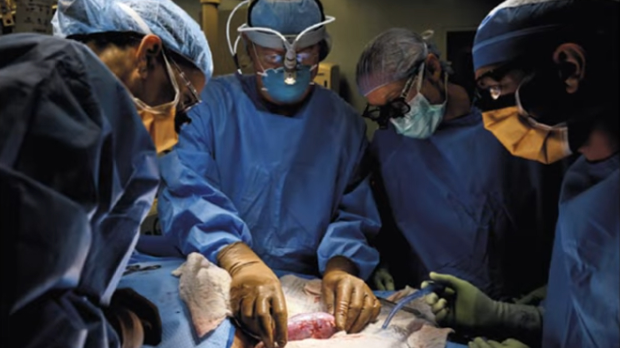 Органи генетски модификованих свиња као нова нада – може ли ксенотрансплантација надмашити људске органе