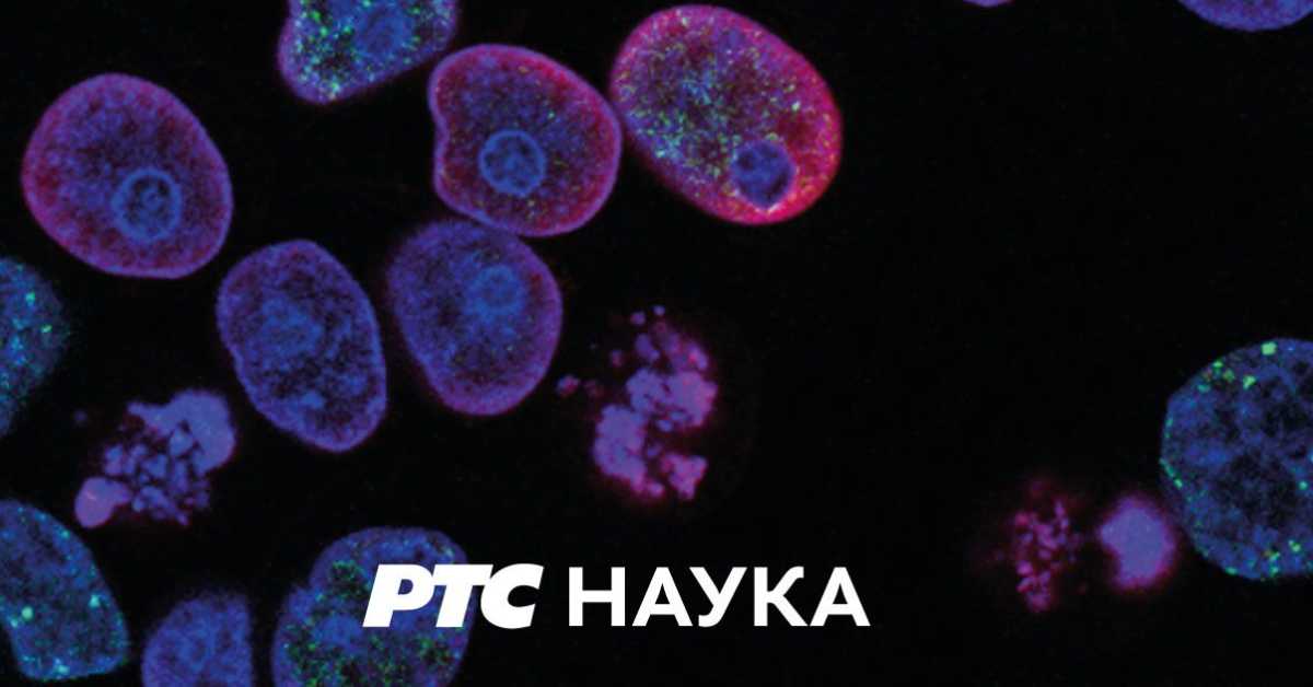 Професионалци: Мики Стојчић Професионалци: Мики Стојчић