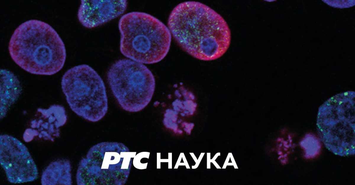 РТС ЛАБ: Анксиозност РТС ЛАБ: Анксиозност