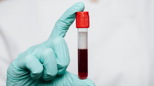 Једна крвна група изгледа да носи већи ризик од дијабетеса типа 2