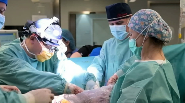 Историјски успех српских лекара – урађена прва трансплантација плућа у Србији