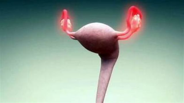 Циљана терапија рака јајника, нова шанса за жене у Србији