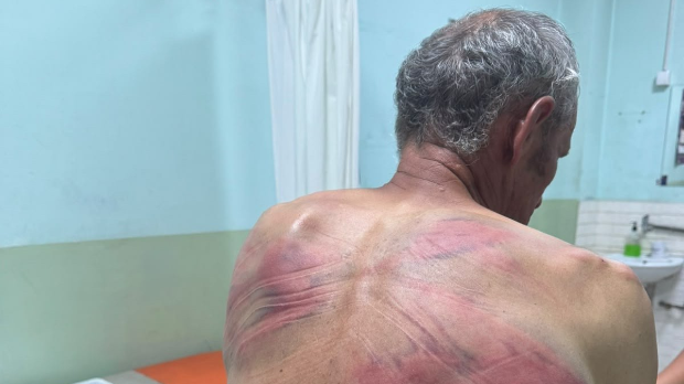 Припадници косовске полиције претукли Ненада Рашковића код Зубиног Потока: Упали су у кућу, малтретирали ми жену и сина