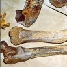 Туберкулоза на костима старим 9.000 година