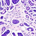 Ћелијски имунитет сузбија канцерогене туморе