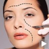 Три-де приказ резултата пре операције 