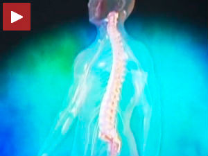 Дискус хернија, болест 21. века