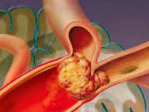 У средишту пажње