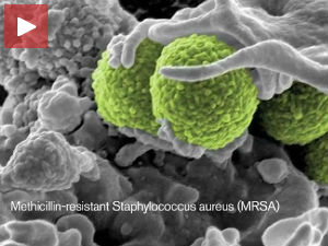 Збогом, антибиотици?