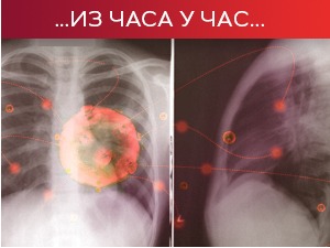 Преминуло још 59 особа, новa 13.772 случаја заразе