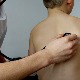 Туберкулозом заражено деветоро деце у Новом Пазару
