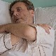 Делиријум тременс, 2-4