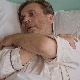 Делиријум тременс, 1-4