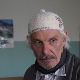 Делиријум тременс, 2-4
